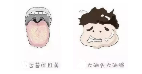 肥胖有湿热，减肥艾灸取穴法