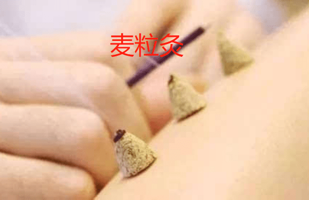 麦粒灸的适应范围与选穴..