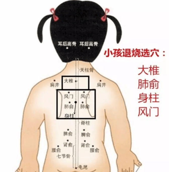 小孩子感冒发烧咳嗽可艾灸治疗