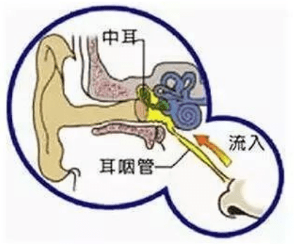 用用吹灸治疗化脓性中耳炎吹灸治疗化脓性中耳炎