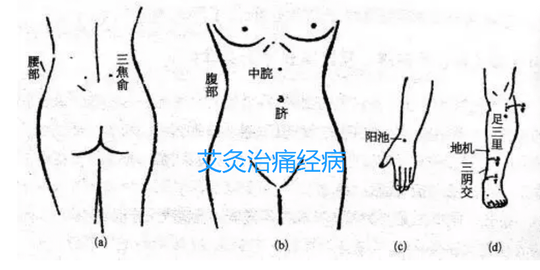 艾灸治痛经取穴位