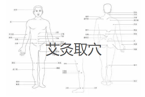 灸法选穴的5方法思路