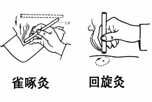 艾灸之【术】:选穴方法与施灸手..