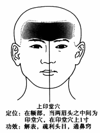 热敏灸治疗【感冒】的方法