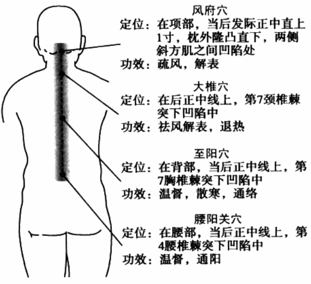 热敏灸治疗【感冒】的方法