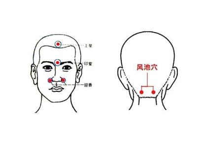 五官科相关疾病：艾灸治疗取穴..