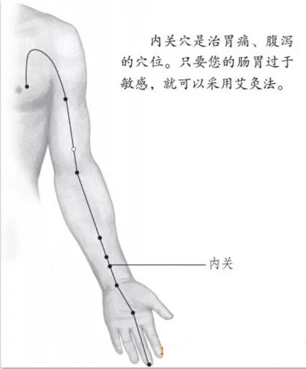 艾灸治疗胃肠痉挛性疼痛