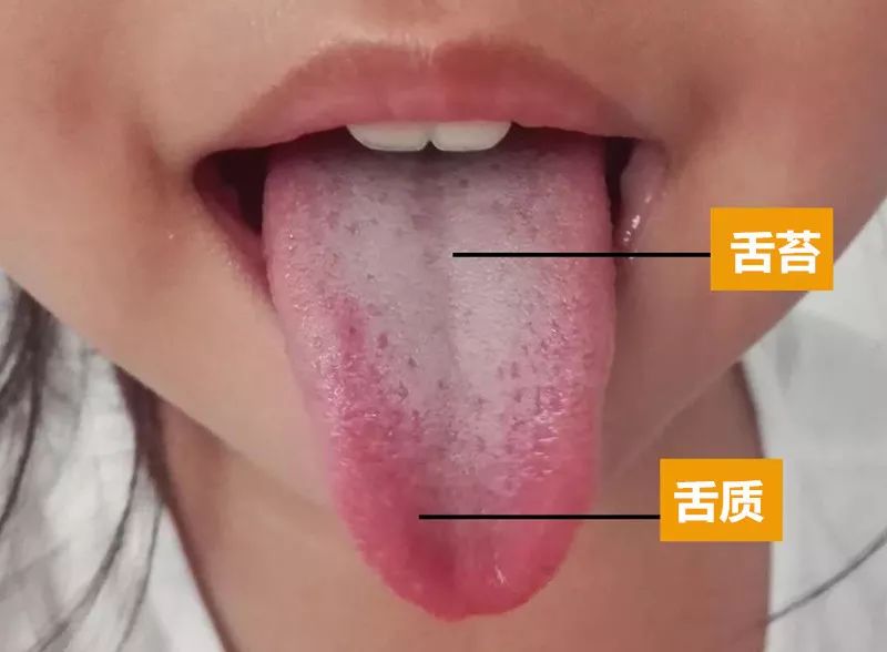 正常的舌苔照片