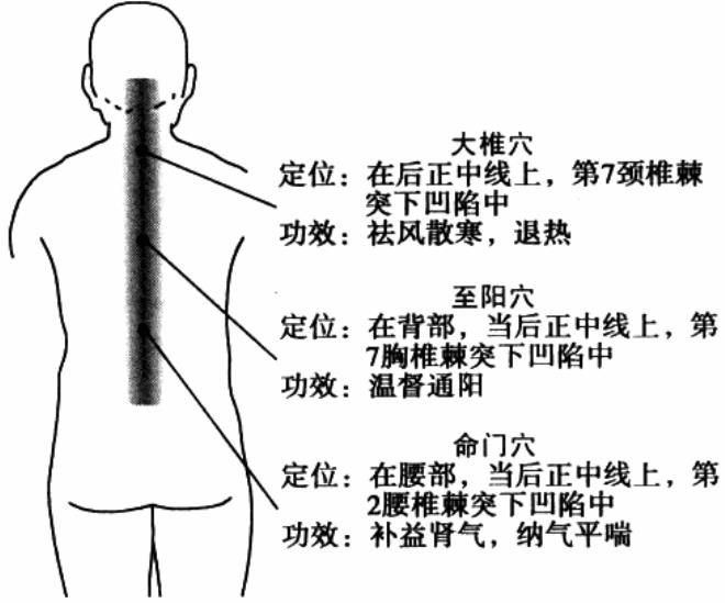 热敏灸治疗慢性支气管炎方法