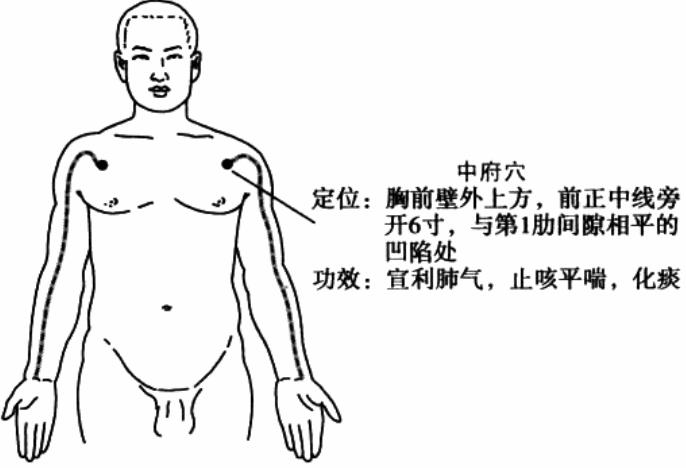 热敏灸治疗慢性支气管炎方法
