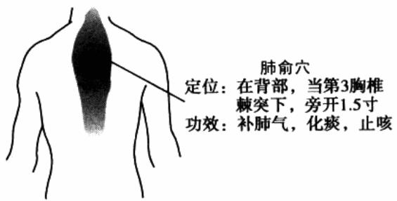 热敏灸治疗慢性支气管炎方法